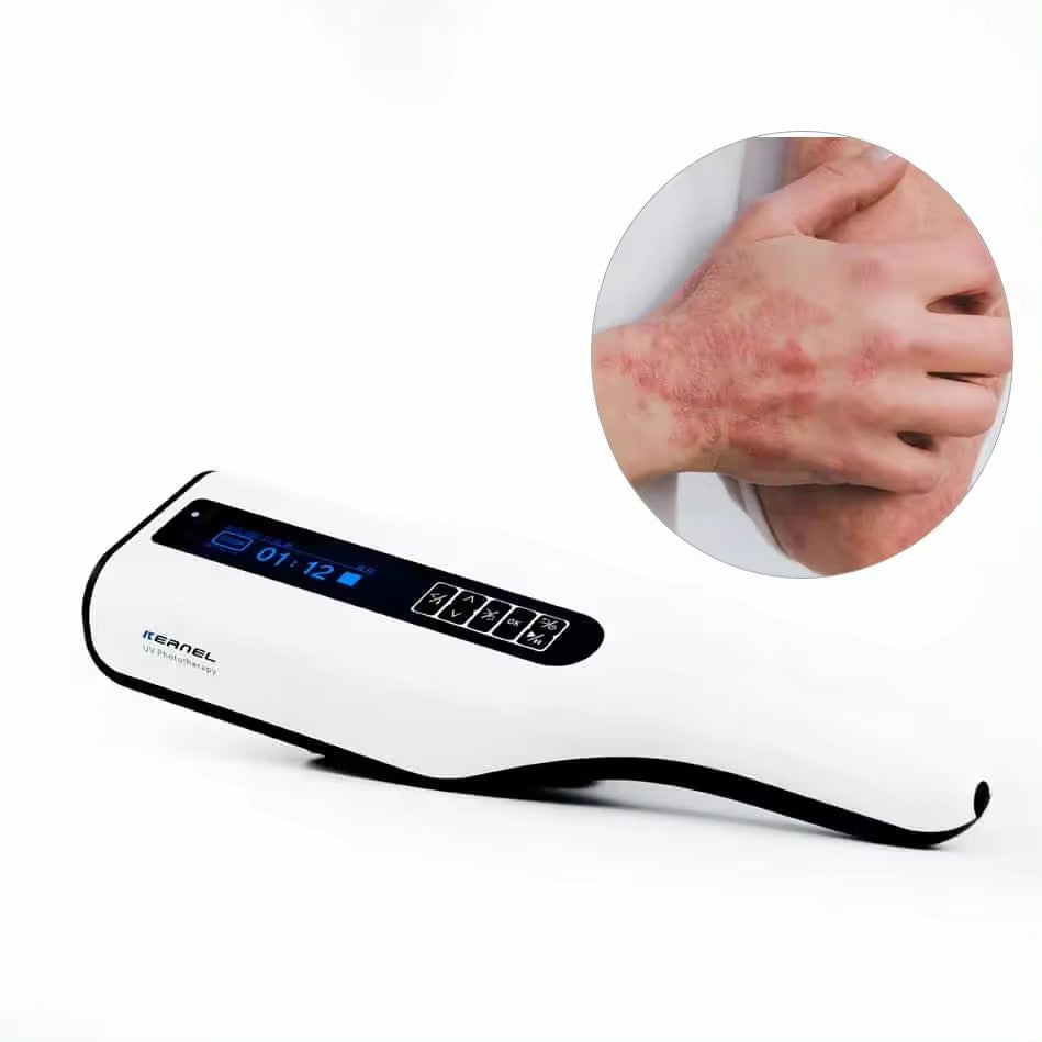 UVB 311nm Hand Lamp for Home Treatment - With Timer - 104cm² - Light Therapy for Vitiligo, Psoriasis, Eczema and Other Skin Conditions - Battery-Free